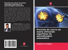 Bookcover of Previsão do cancro da mama utilizando algoritmos de aprendizagem automática