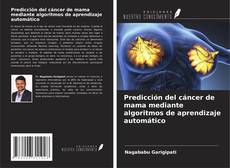 Bookcover of Predicción del cáncer de mama mediante algoritmos de aprendizaje automático