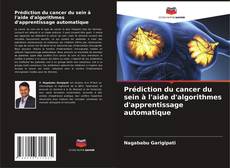 Bookcover of Prédiction du cancer du sein à l'aide d'algorithmes d'apprentissage automatique