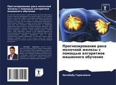 Bookcover of Прогнозирование рака молочной железы с помощью алгоритмов машинного обучения