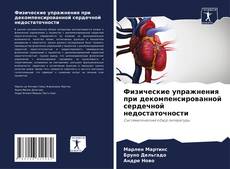 Buchcover von Физические упражнения при декомпенсированной сердечной недостаточности