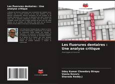 Copertina di Les fluorures dentaires : Une analyse critique