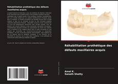 Copertina di Réhabilitation prothétique des défauts maxillaires acquis