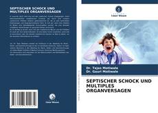 Bookcover of SEPTISCHER SCHOCK UND MULTIPLES ORGANVERSAGEN