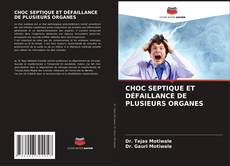 CHOC SEPTIQUE ET DÉFAILLANCE DE PLUSIEURS ORGANES的封面