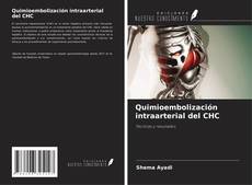 Copertina di Quimioembolización intraarterial del CHC