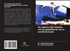Bookcover of Un aperçu des lésions verrucopapillaires de la cavité buccale