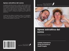 Bookcover of Apnea ostruttiva del sonno