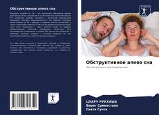 Bookcover of Обструктивное апноэ сна