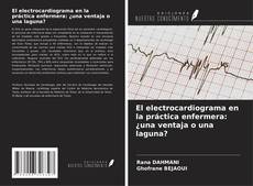 Copertina di El electrocardiograma en la práctica enfermera: ¿una ventaja o una laguna?
