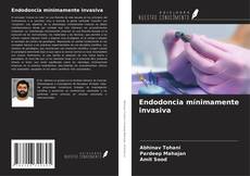 Buchcover von Endodoncia mínimamente invasiva