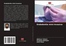 Bookcover of Endodontie mini-invasive