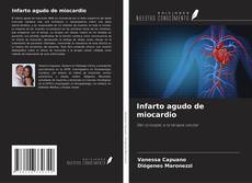 Bookcover of Infarto agudo de miocardio