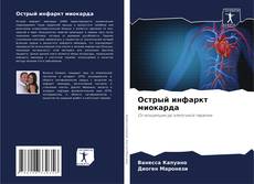 Buchcover von Острый инфаркт миокарда