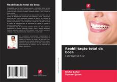 Bookcover of Reabilitação total da boca