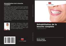 Portada del libro de Réhabilitation de la bouche complète