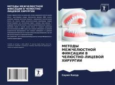 Bookcover of МЕТОДЫ МЕЖЧЕЛЮСТНОЙ ФИКСАЦИИ В ЧЕЛЮСТНО-ЛИЦЕВОЙ ХИРУРГИИ