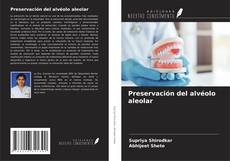 Bookcover of Preservación del alvéolo aleolar
