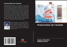 Bookcover of Préservation de l'alvéole