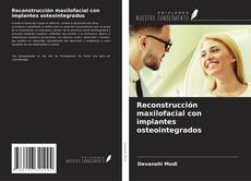 Bookcover of Reconstrucción maxilofacial con implantes osteointegrados