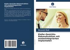 Kiefer-Gesichts-Rekonstruktion mit ossteointegrierten Implantaten kitap kapağı