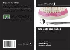 Capa do livro de Implante cigomático 