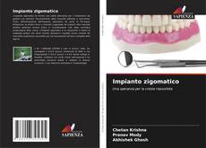 Bookcover of Impianto zigomatico