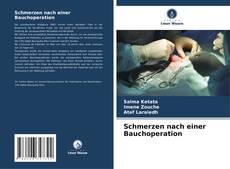 Portada del libro de Schmerzen nach einer Bauchoperation