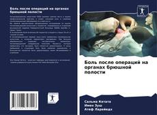 Bookcover of Боль после операций на органах брюшной полости