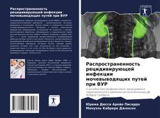 Bookcover of Распространенность рецидивирующей инфекции мочевыводящих путей при ВУР