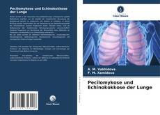 Bookcover of Pecilomykose und Echinokokkose der Lunge