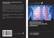 Bookcover of Pecilomicosis y equinococosis de los pulmones
