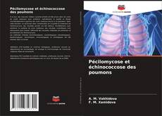 Capa do livro de Pécilomycose et échinococcose des poumons 