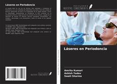 Bookcover of Láseres en Periodoncia