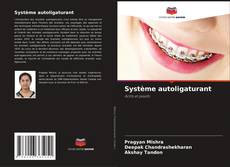 Bookcover of Système autoligaturant