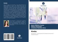 Couverture de Krebs