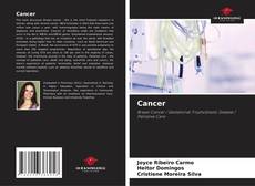 Bookcover of Cancer
