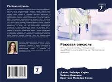 Buchcover von Раковая опухоль
