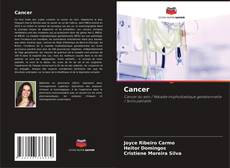 Bookcover of Cancer