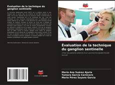 Bookcover of Évaluation de la technique du ganglion sentinelle
