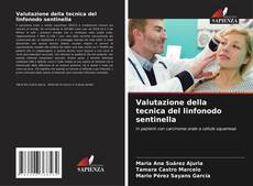 Bookcover of Valutazione della tecnica del linfonodo sentinella