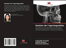 Bookcover of Gestion de l'apertognathie