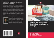 Capa do livro de Falhas em implantes dentários: etiologia e manejo 
