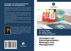 Couverture de Versagen von Zahnimplantaten: Ätiologie und Management