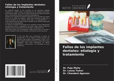 Fallos de los implantes dentales: etiología y tratamiento kitap kapağı