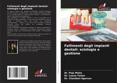 Copertina di Fallimenti degli impianti dentali: eziologia e gestione