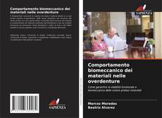 Copertina di Comportamento biomeccanico dei materiali nelle overdenture