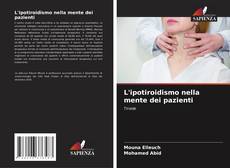 L'ipotiroidismo nella mente dei pazienti的封面