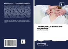 Bookcover of Гипотиреоз в сознании пациентов