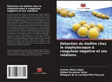 Bookcover of Détection du biofilm chez le staphylocoque à coagulase négative et ses relations